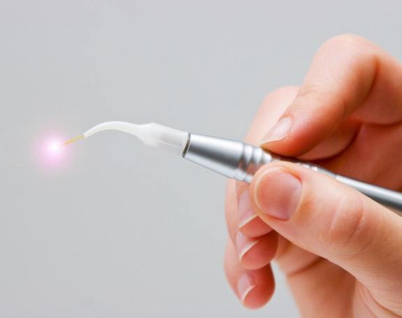 Soft tissue laser dentistry tool